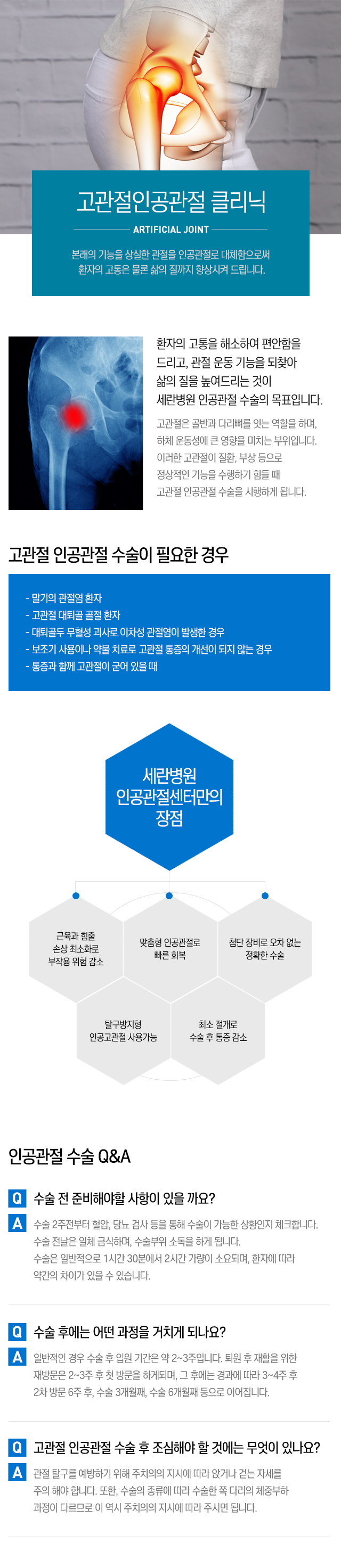 무릎인공관절클리닉