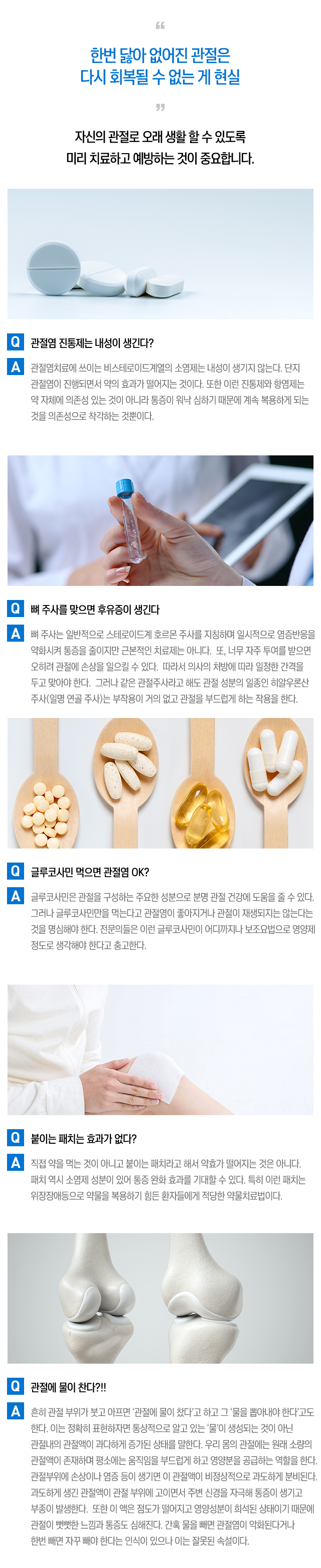 관절염 치료 FAQ