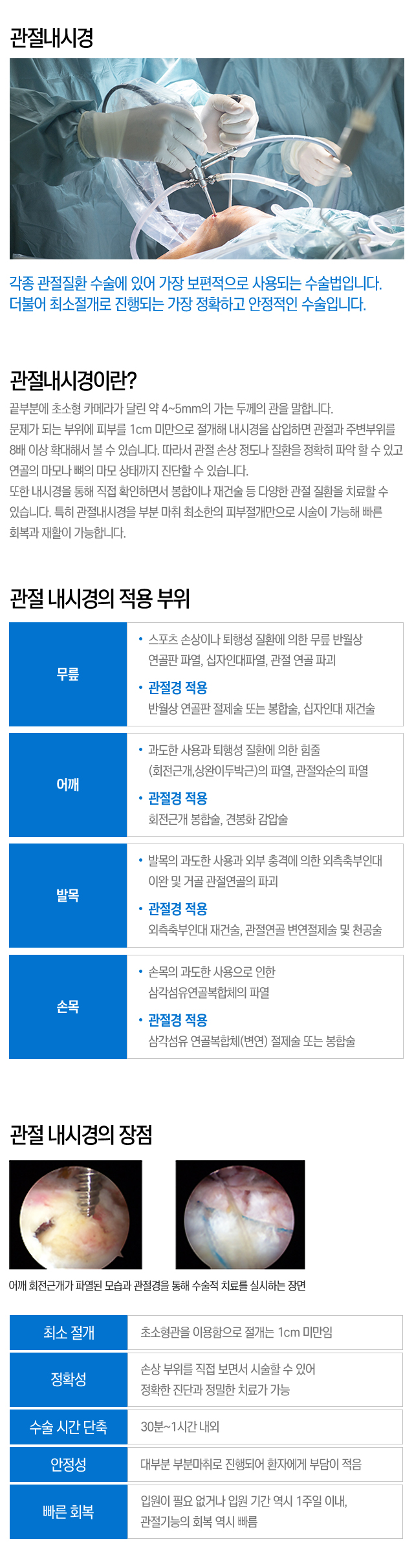 관절내시경