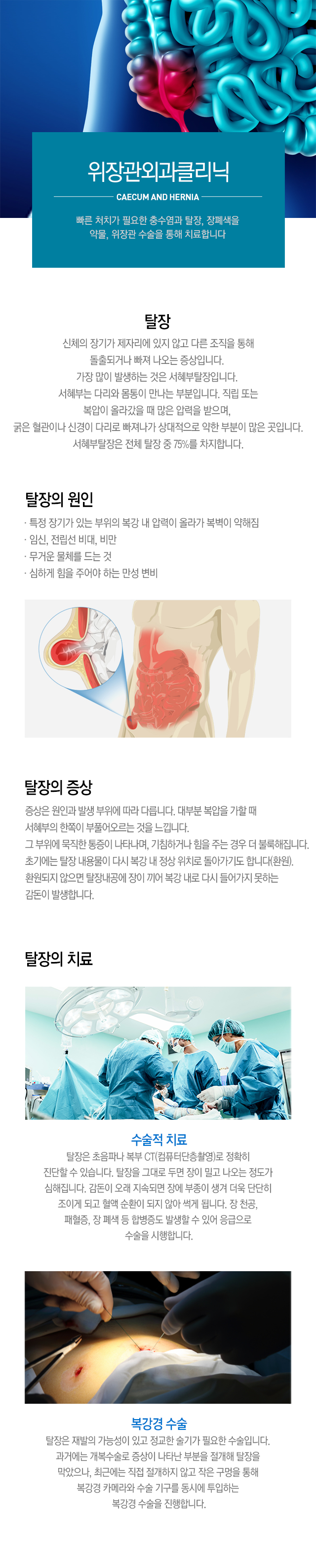 탈장클리닉