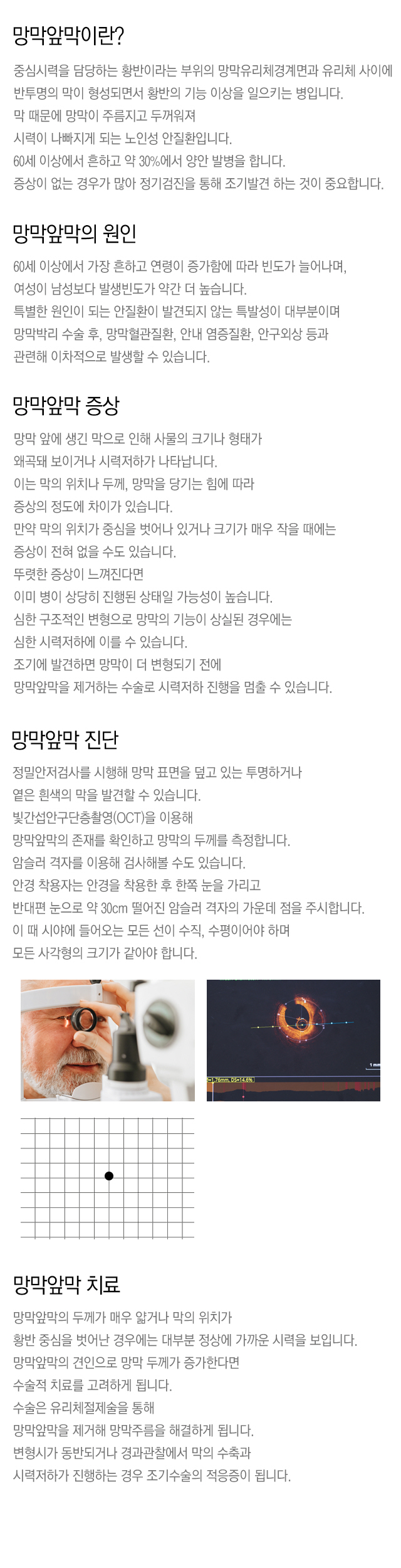 망막앞막