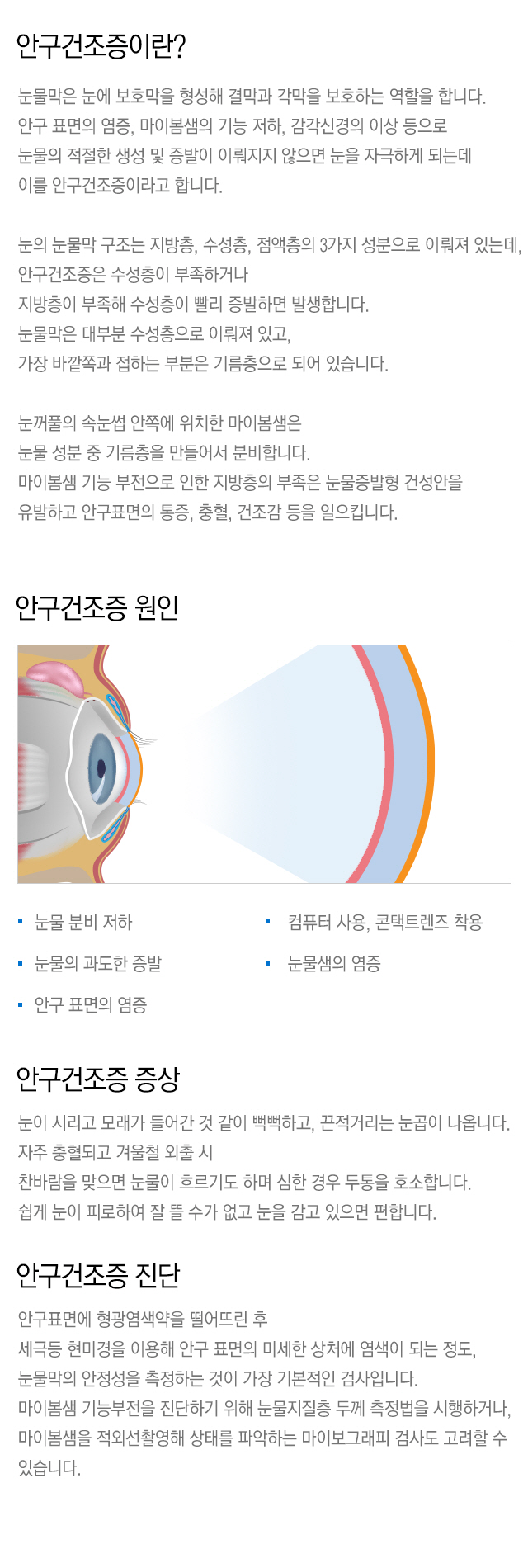 안구건조증